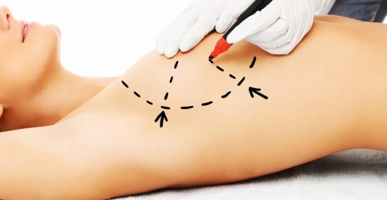 breast_surgeries-870x450-1